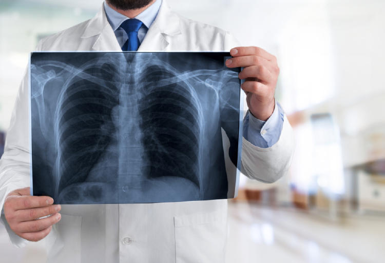 médico radiografía neumonia