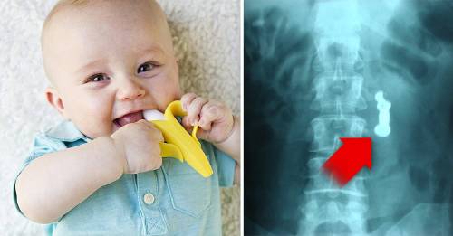 ¿Qué hacer si mi hijo se tragó un objeto? ¿Qué hacer si mi hijo se tragó un objeto?