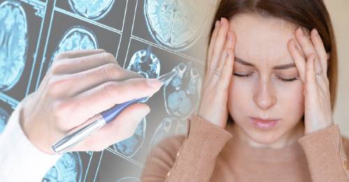 Sufrir de migrañas te fortalece: Harvard afirma que sirven de protección