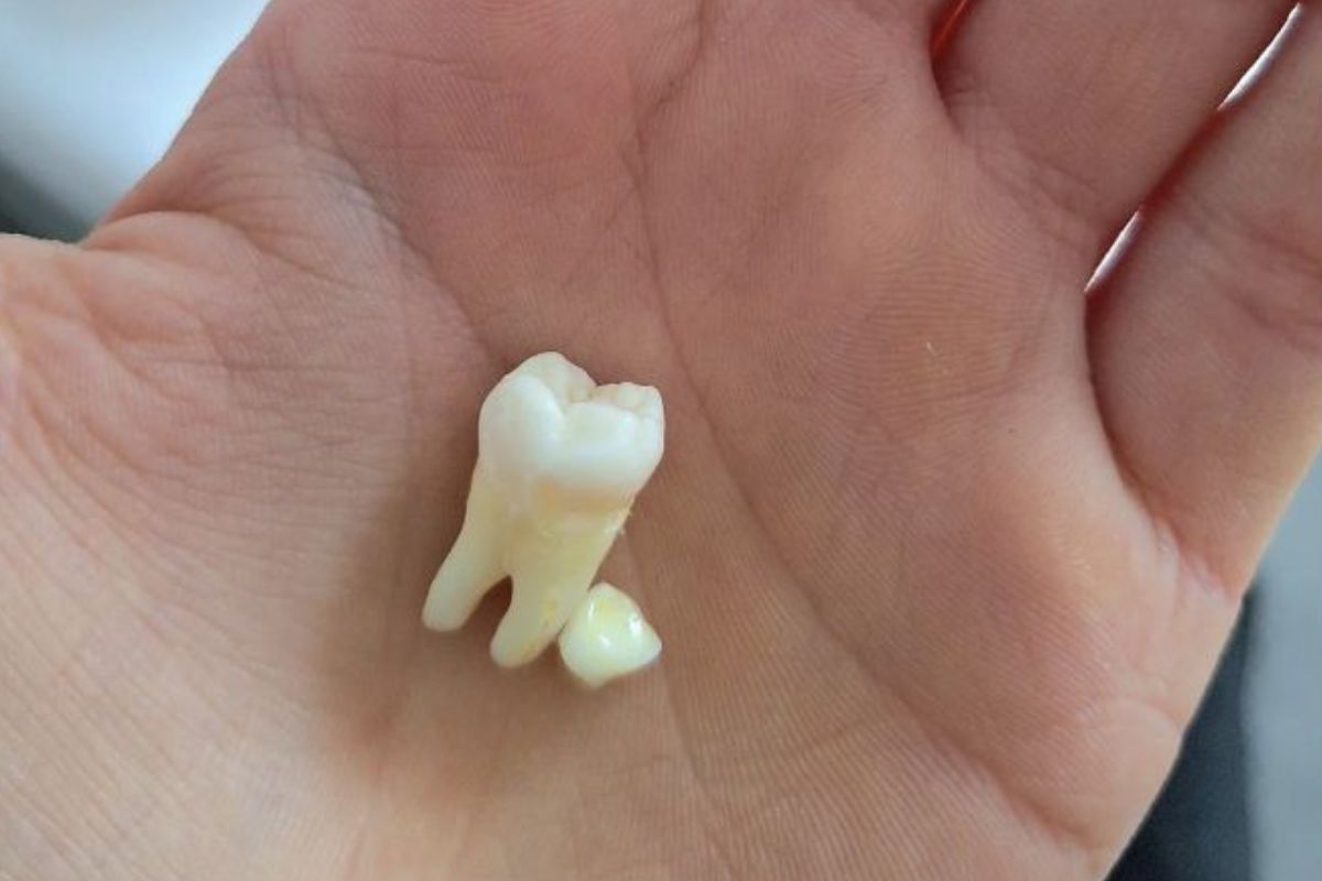 Lo que antes era un simple procedimiento dental podría transformarse en un recurso vital para la medicina del futuro. (PINTEREST)