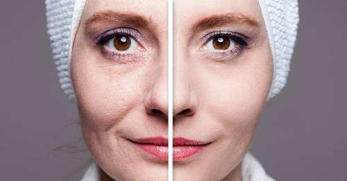 aguas termales exclentes piel remplazo aguas termales exclentes piel remplazo