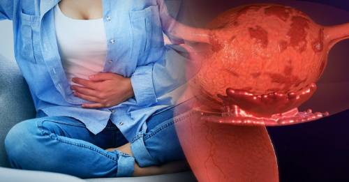 Esta mujer se disfrazó de endometriosis para Halloween y conmovió a todo el mundo