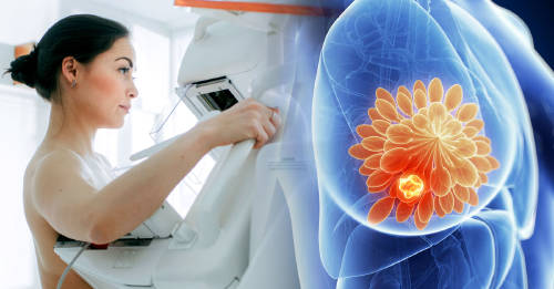 Desarrollan un método para detectar cáncer 5 años antes de que aparezca