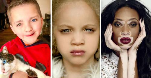 10 personas que la Naturaleza las hizo con una apariencia mágica