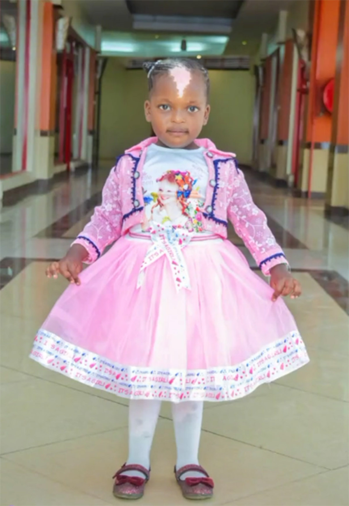 niña mancha blanca2 niña mancha blanca2