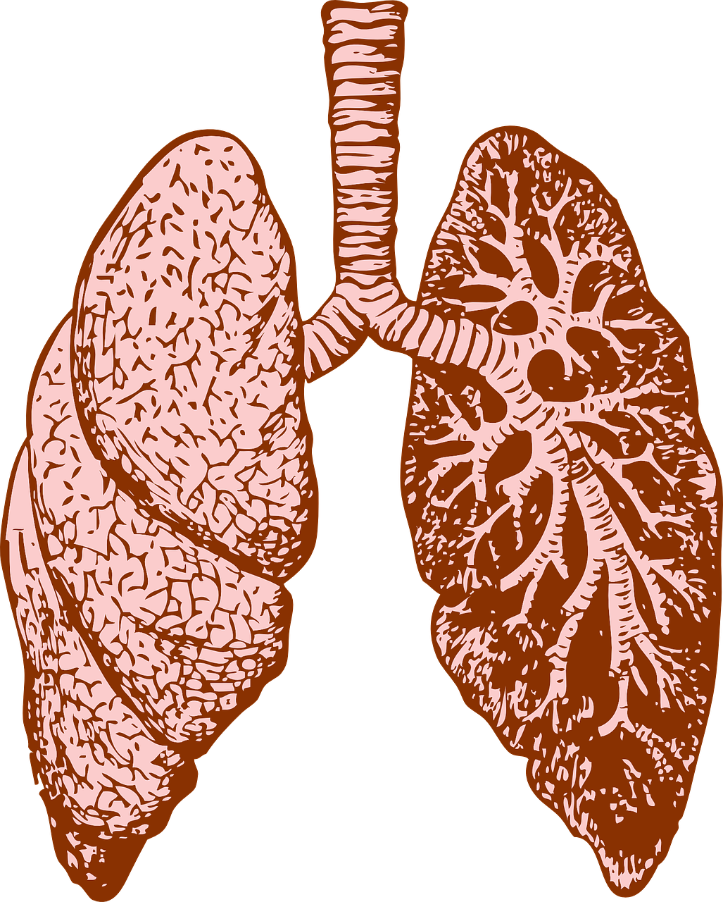 fibrosis pulmonar síntomas