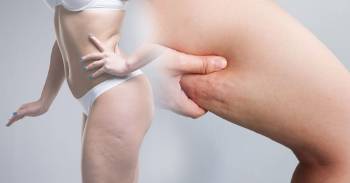 Los 2 mejores ejercicios para eliminar la celulitis de los muslos Los 2 mejores ejercicios para eliminar la celulitis de los muslos