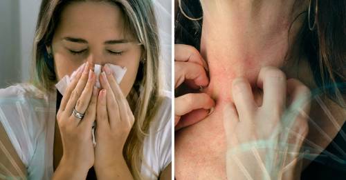 Qué significado emocional tienen las alergias según la biodescodificación Qué significado emocional tienen las alergias según la biodescodificación